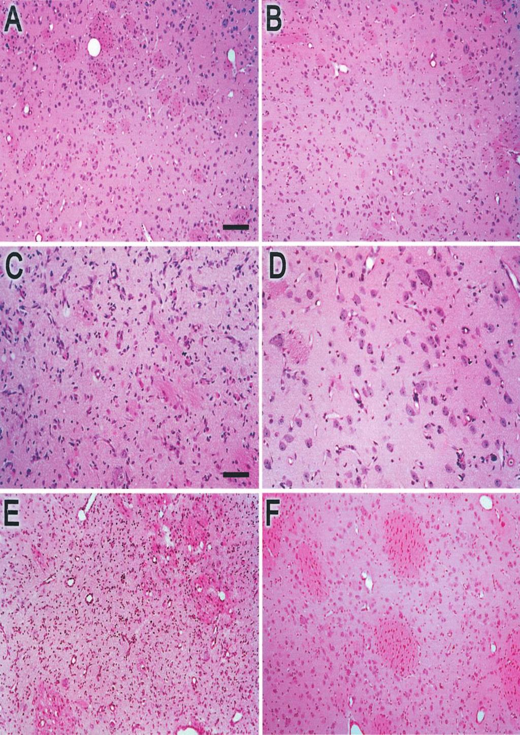 Hypothermia for 24 Hours After Asphyxic Cardiac Arrest in Piglets Provides Striatal Neuroprotection That Is Sustained 10 Days After Rewarming Dawn M.