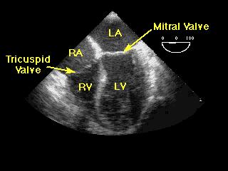 Echocardiography Ventricular function Volume status Cardiac output