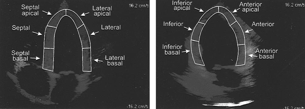 Arq Bras Cardiol Silva et al Basically, Doppler tissue imaging was developed based on the physical differences between moving blood and moving myocardium.