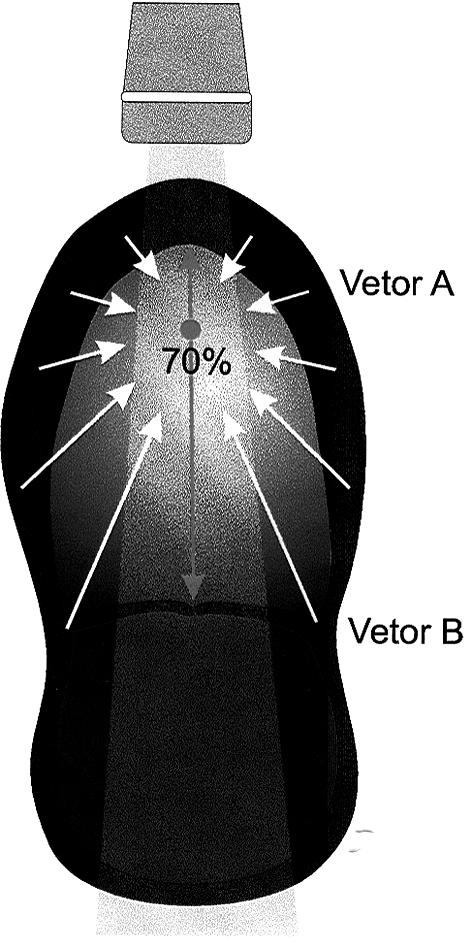 Silva et al Arq Bras Cardiol Vector A Vector B Fig. 5 The resulting vector of the myocardial movement is directed by a point inside the ventricle at approximately 70% of its longitudinal diameter.