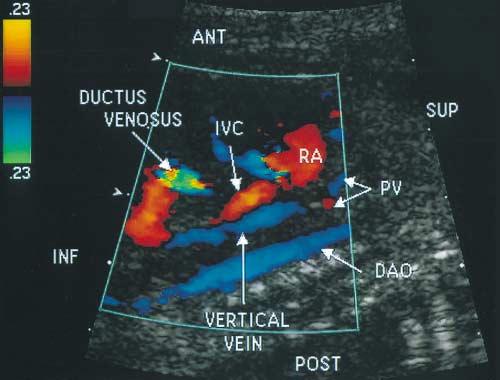 aorta behind through the diaphragm to the liver to join the ductus venosus.