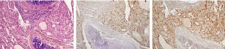 PPFP;PtenFF;Cre mice develop metastatic thyroid carcinoma Tracheal