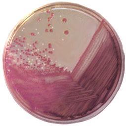 lactosefermenting (pink) colonies,
