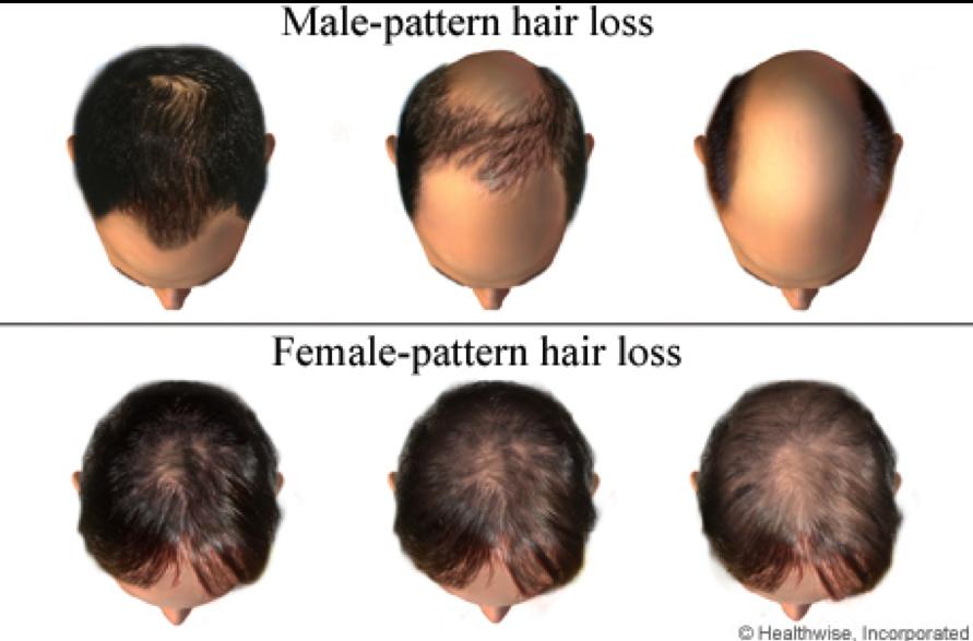 Thus, males can inherit baldness from their mothers Pair-Share-Respond 1.