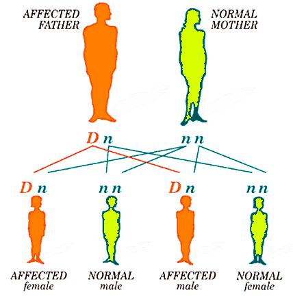 Autosomal dominant inheritance D abnormal gene d normal gene Each child of an