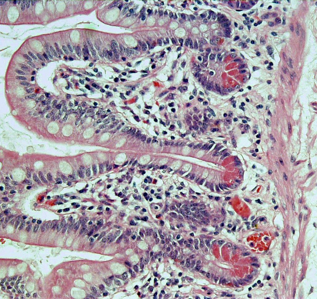 Paneth Cells at the base of the Crypts Paneth cells play a role in regulation of normal bacterial flora of the small intestine.