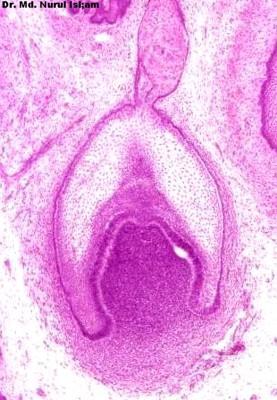 bud) Inner enamel epithelium