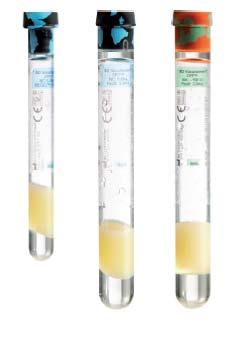 BD Vacutainer CPT System Features & Benefits Sterile, closed-system method for isolating mononuclear cells from venous blood For diagnostic Use CE, 510(k) Available with Sodium Citrate (4 ml and 8