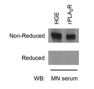 The PLA2R epitope identified by MN autoantibodies is