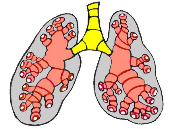 Asthma changes the lung airways in 3 ways: