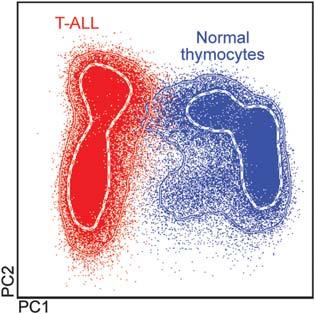 1938 Figure 17. Overall immunophenotypic profile of T-acute lymphoblastic leukemia (ALL) blast cells (red dots) versus normal human thymocytes (blue dots) as assessed by the EuroFlow T-ALL panel.
