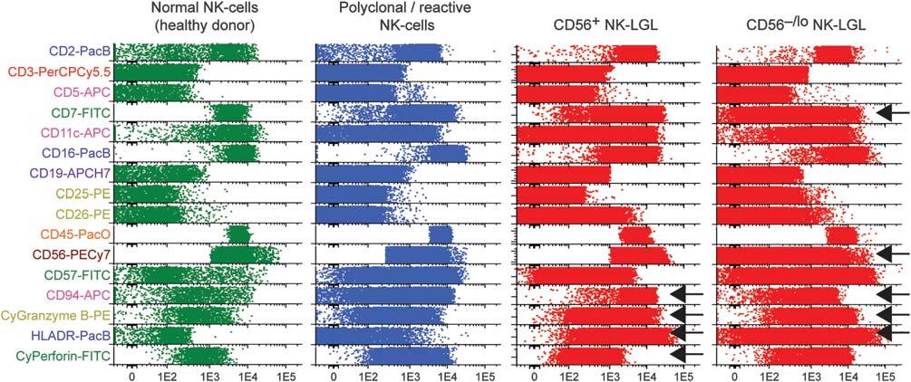 1956 Figure 29. Comparative principal component (PC) 1 versus PC2 views of clonal versus both normal and reactive NK-cell reference cases.
