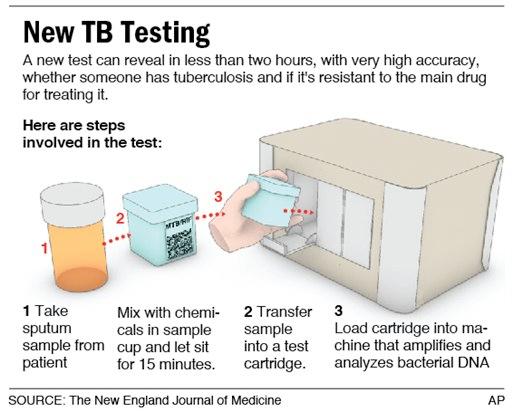New technology for active TB testing PCR-based molecular test Xpert MTB/RIF (Cepheid) outperforms IGRAS in diagnosis of