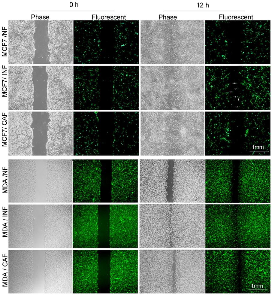 3512 123 (20) Fig. 6. Effect of fibroblasts on cancer cell migration in an in vitro direct co-culture system.