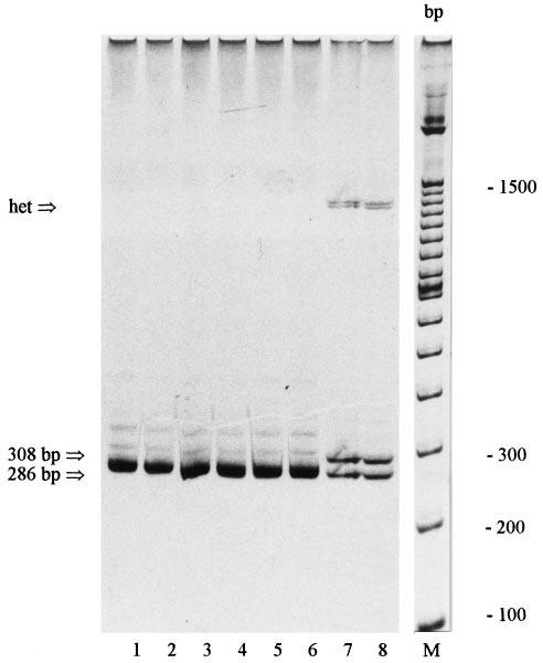 MUIR TORRE SYNDROME 915 Figure 3. Heteroduplex analysis of exon 2 of the hmsh2 gene.