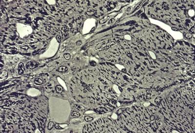 Myocyte-capillary mismatch in experimental