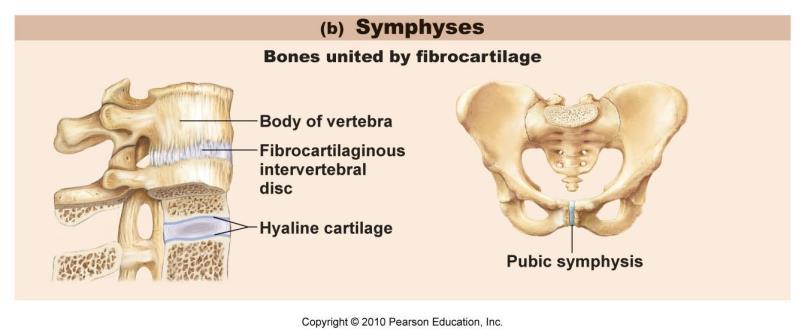 vertebral joints that absorb compression reduces friction Bursa: fibrous, saclike structures that are lined by