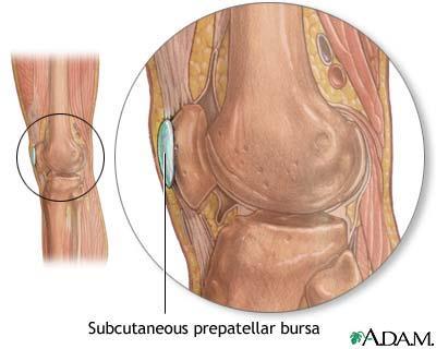 Bursa fluid-filled sac that cushions between bones & tendons/muscles Types of Synovial Joints 1. Plane wrist 2.