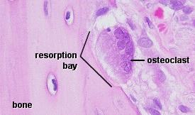3. Osteoclasts Cells that digest