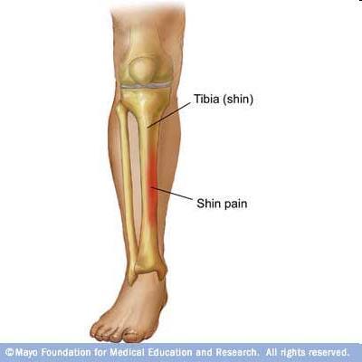 Lower Leg Injuries