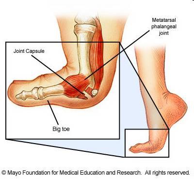 Feet/ Toe Injuries