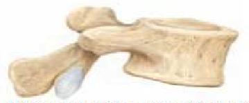 The following table provides examples of these bone types. Bone Type Long Short Description and Examples which are longer than they are wide and made up primarily of compact bone.