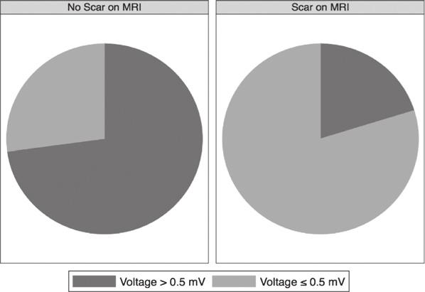 Spragg et al Magnetic Resonance Imaging of Left Atrial Scar 2007 Normal Voltage (>0.5 mv) Low Voltage ( 0.