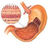Section through stomach wall Muscular fibres Gastric gland secretes acid and enzymes that make up gastric juice Muscular sphincter Diaphragm Circular fibres NORMAL DIGESTION The swallowing process To