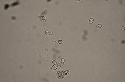 Microscopic examination of urine Microbes Microbes are usually present because of the normal flora of genitals Because of their