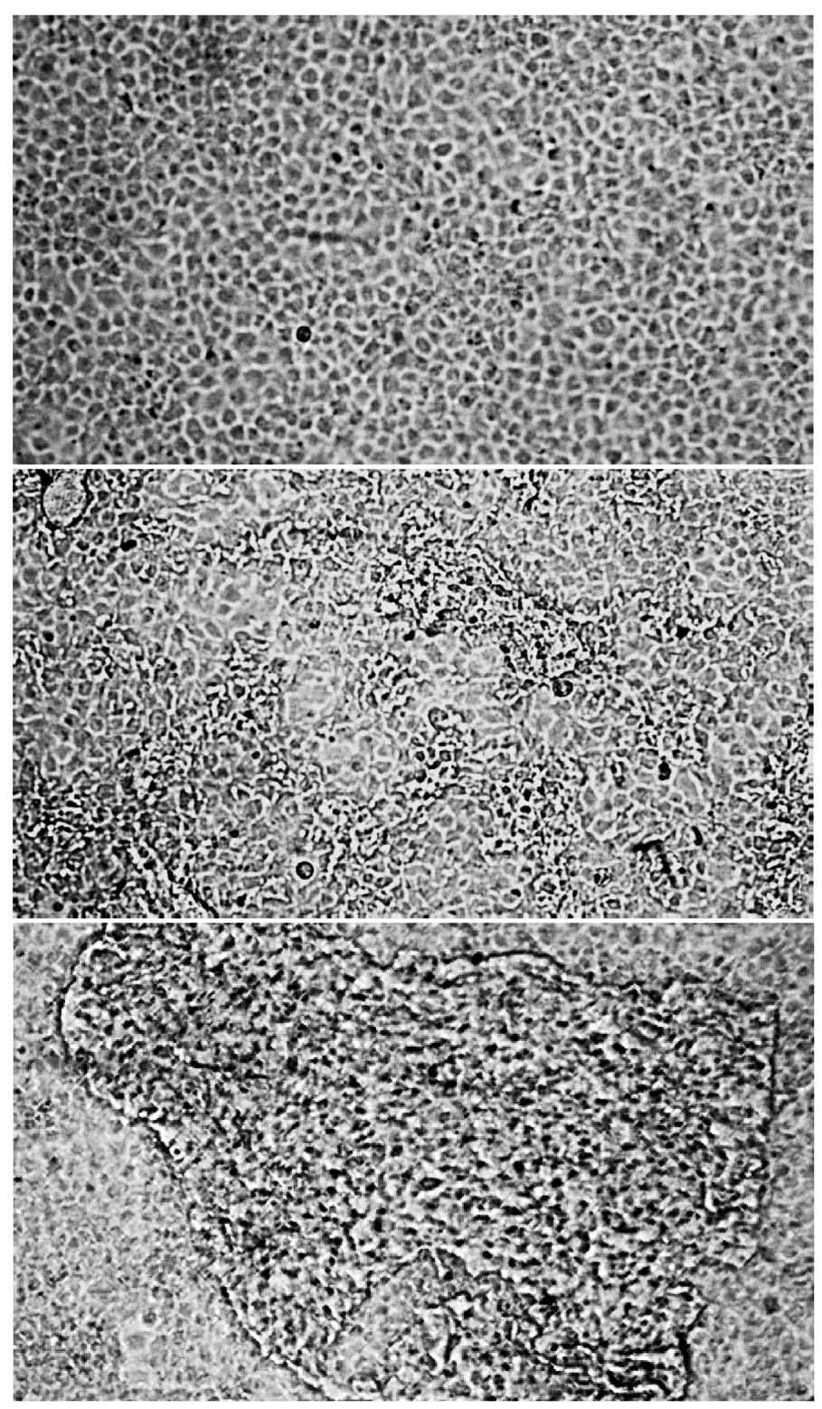 Zhang et al.: LV propagation in fish-culture cells 29 ml 1 Hoechst 33258 for 15 min.