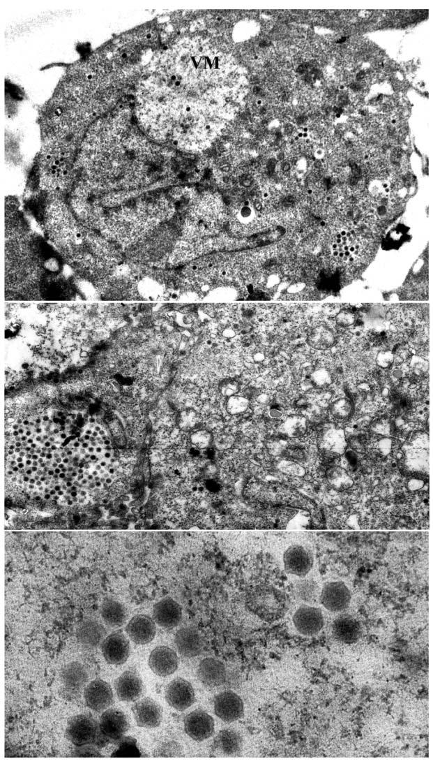 Zhang et al.: LV propagation in fish-culture cells 31 A B C Fig. 3. Electron micrographs of infected cell and propagated virus particles.