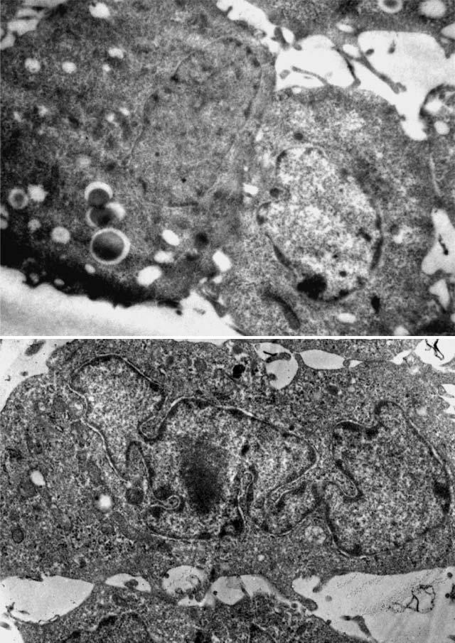 32 Dis Aquat Org 57: 27 34, 2003 A B Fig. 4. Cellular changes observed by electron microscopy in infected GCO cells.