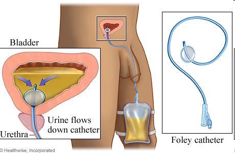 Contouring of the prostate and
