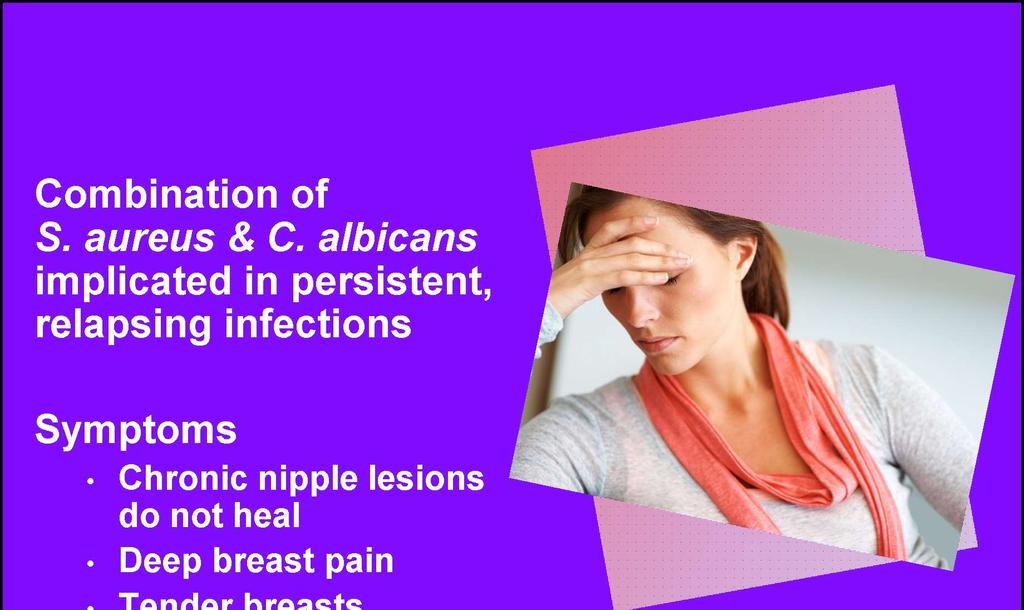 Combination of S. aureus & C. albicans implicated in persistent, relapsing infections Symptoms Chronic nipple lesions do not heal Deep breast pain Tender breasts Eglash, et al.