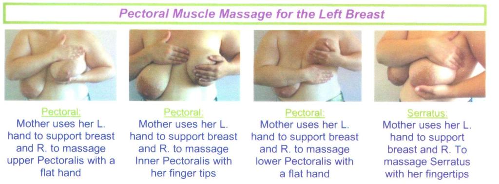 Mammary Constriction Syndrome http://www.breastfeedinginc.ca/product.php?