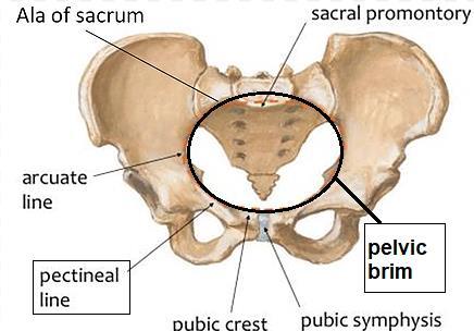 components of the sacrum, ilium, pubic bone and symphysis pubis, and this line has