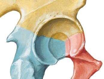 The Acetabulum It is a C-shaped cavity located on the lateral aspect of the hip bone directed laterally, downwards