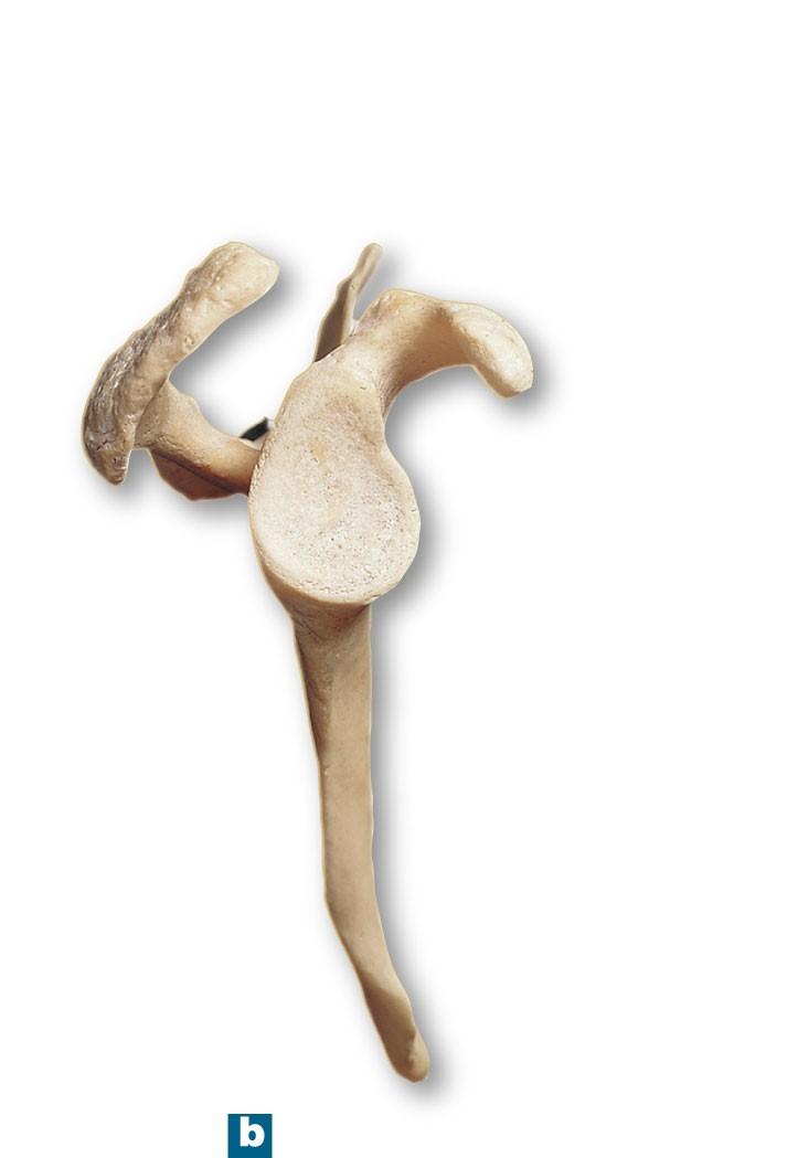 Figure 8-3b The Right Scapula Supraglenoid tubercle Acromion Coracoid
