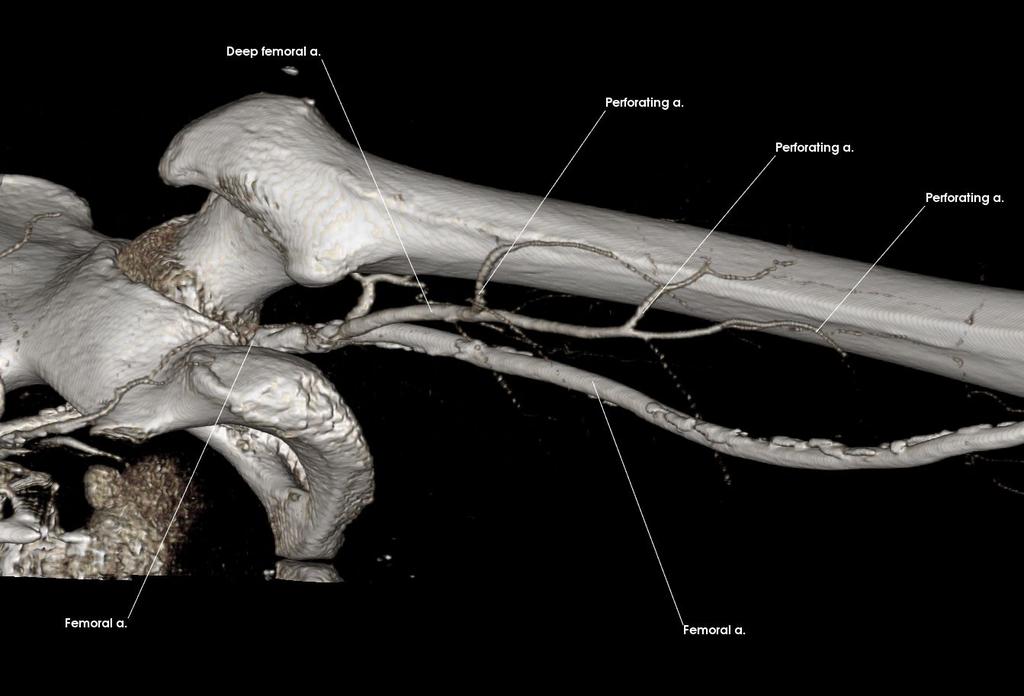 1. c. Obturator Artery (Anterior) Deep femoral a. Femoral a.