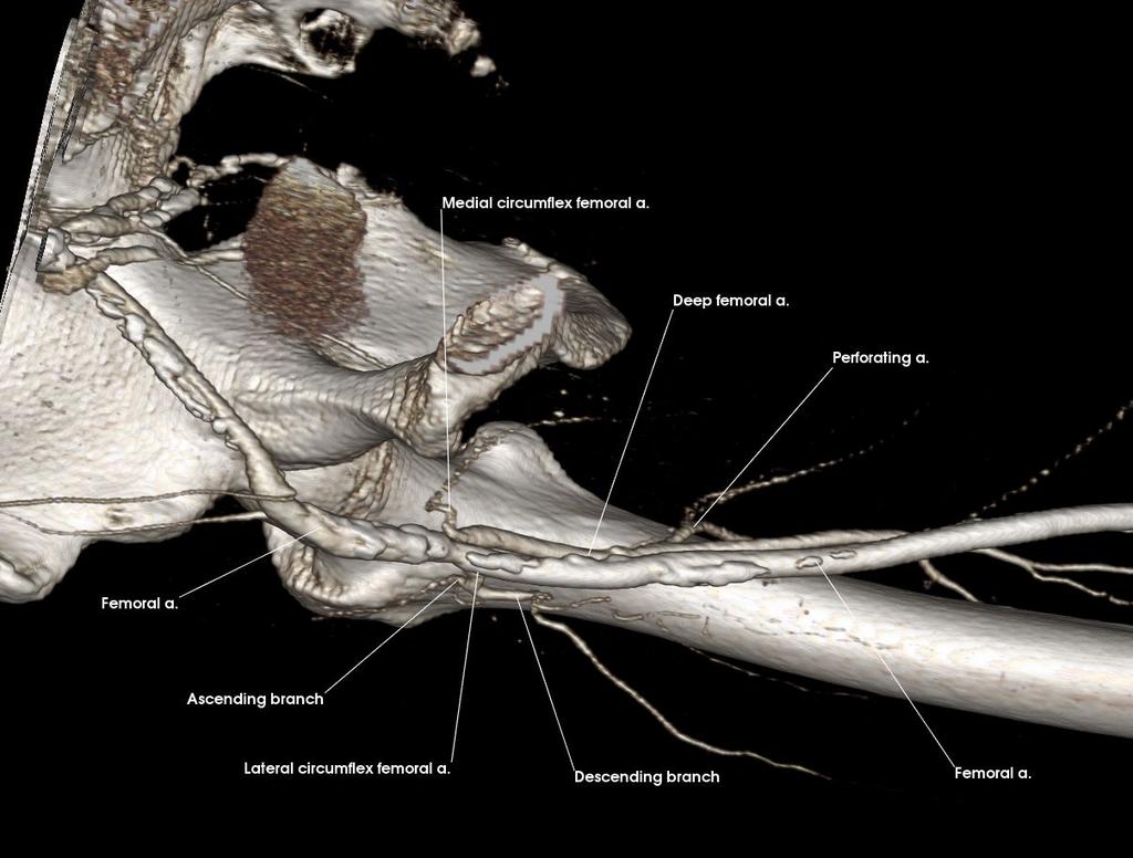 Deep Femoral Artery (Posterior) Ascending branch Deep femoral a.