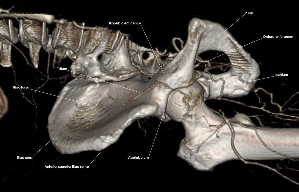 Lower Limb 1- The Skeletal System 1: Hip Bone Describe the three bones comprising the hip bone Acetabulum Anterior superior iliac spine Iliac