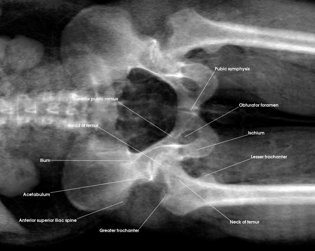 Hip Joint (Anterior) Acetabulum Anterior superior iliac spine Greater