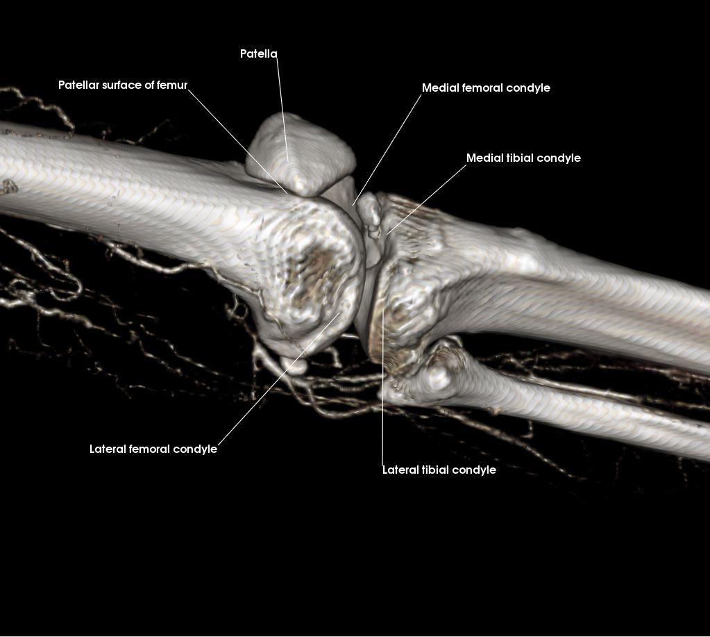 3: Patella and Knee Joint Describe the bony articulations of the knee Describe the ligamentous structures of the knee