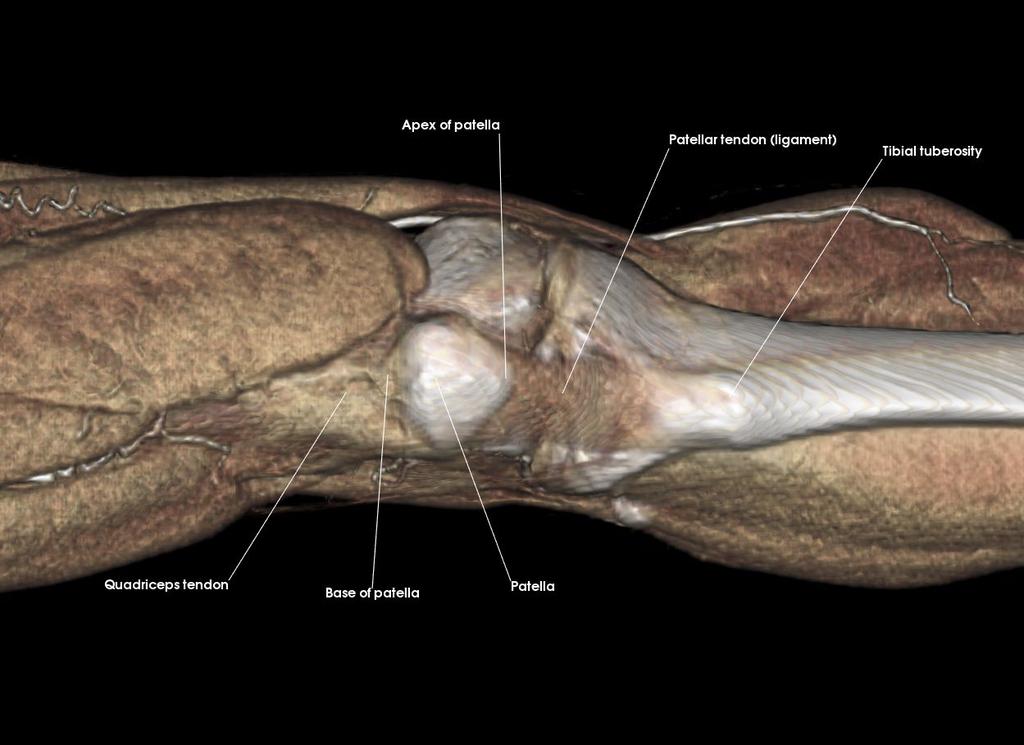 femoral condyle Medial tibial condyle Patella Patellar surface of femur 3. a.