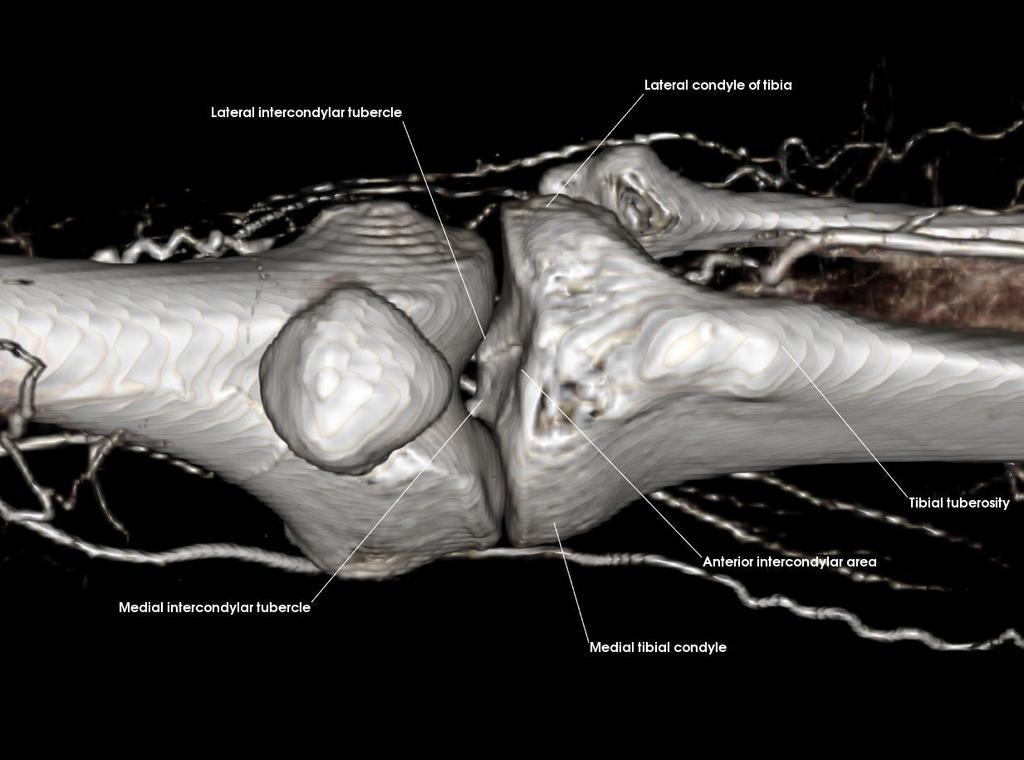 Patella (Posterior) Anterior interconylar area Lateral condyle of tibia