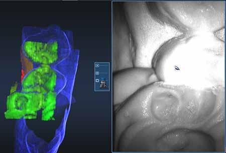 8 Activate the scanner and scan begin the scans with the occlusal of one of the