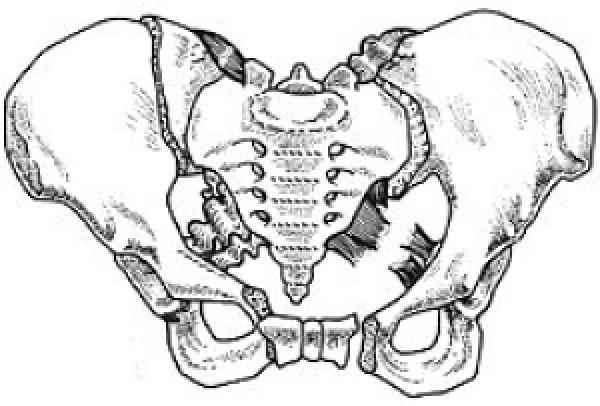 LC- III injuries: Forces crosses midline to contralateral hemipelvis.