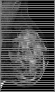 Reconstructed Tomosynthesis Slices D Dose Mammogram Projection Images 15