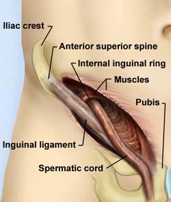 Inguinal canal Inguinal canal Spermatic cord An oblique