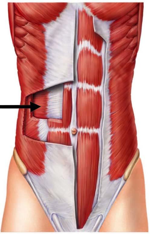 The muscles of antrolateral abdominal walls Ant.
